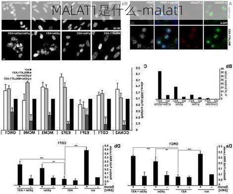 MALAT1是什么-malat1